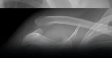 Cette boisson abime vos os de linterieur et pourtant tout le monde la consomme.jpg