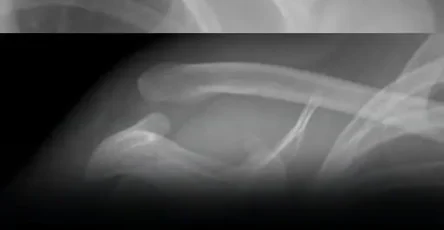 Cette boisson abime vos os de linterieur et pourtant tout le monde la consomme.jpg