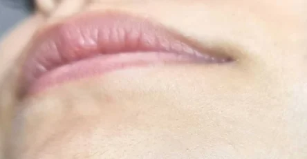 Si vous etes une femme avec des poils au menton soyez attentive voici ce que cela signifie.jpg