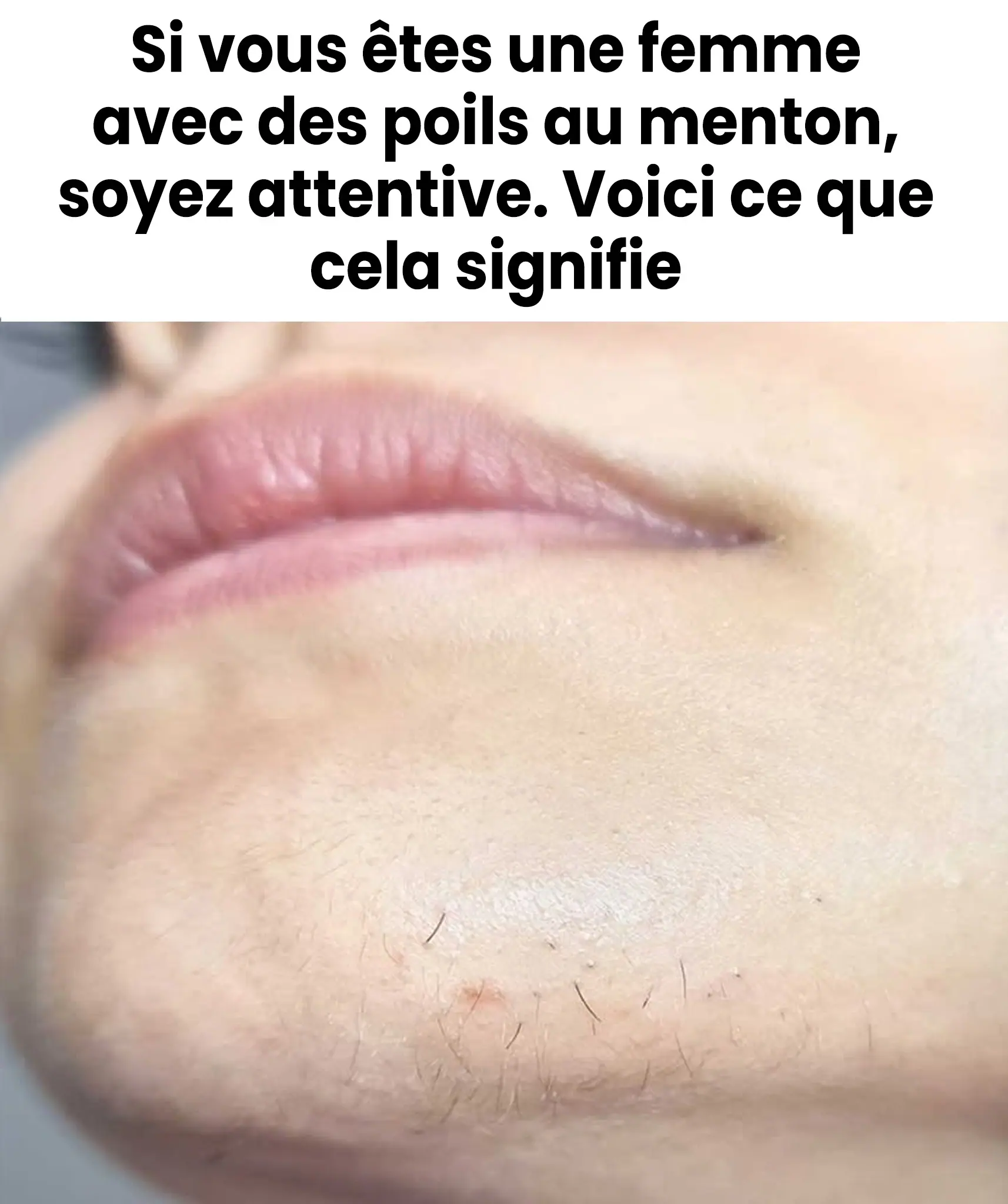 Si vous etes une femme avec des poils au menton soyez attentive voici ce que cela signifie.jpg
