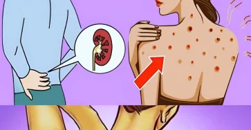 10 signes que vous avez un probleme aux reins 1.jpg