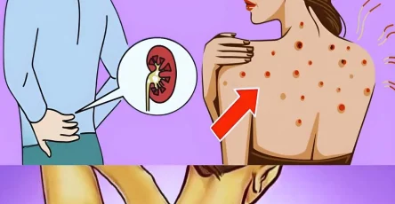 10 signes que vous avez un probleme aux reins 1.jpg