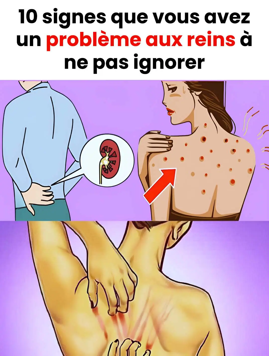 10 signes que vous avez un probleme aux reins 1.jpg