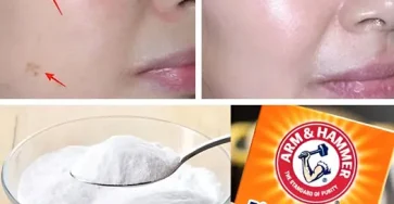 4 facons deffacer les taches de vieillesse avec du bicarbonate de soude pour une peau plus jeune et plus uniforme 1.jpg