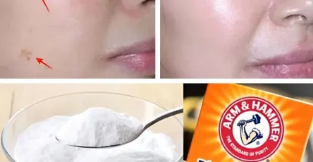 4 facons deffacer les taches de vieillesse avec du bicarbonate de soude pour une peau plus jeune et plus uniforme 1.jpg