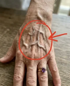 Si vos veines sont visibles voici ce que cela signifie.jpg