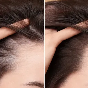 Chute cheveux